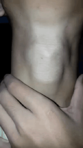 Adam Apple Swallow GIF