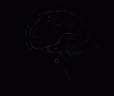 Brain Rot Brainrot GIF