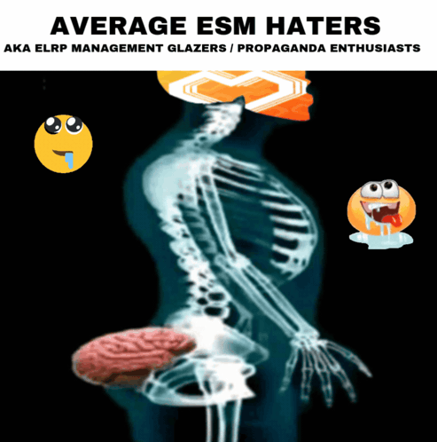 Esm Brain Dead GIF