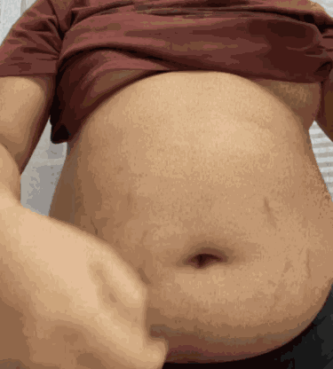 Belly Fat GIF