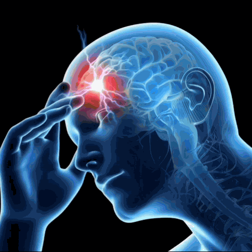 Facepalm Headache GIF