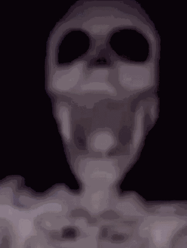 Skeleton Dead GIF