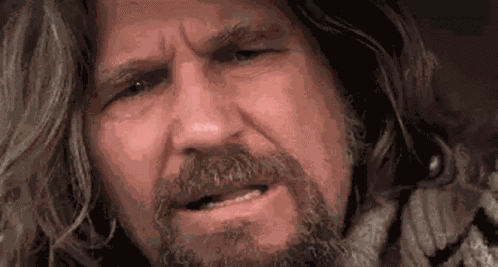 Wtf Blink GIF